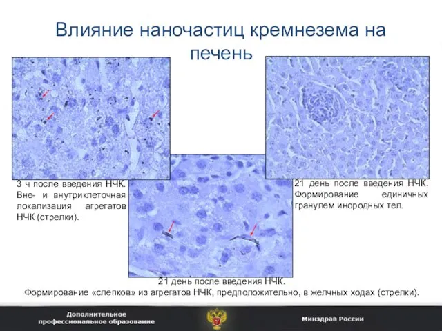 Влияние наночастиц кремнезема на печень 3 ч после введения НЧК. Вне- и внутриклеточная