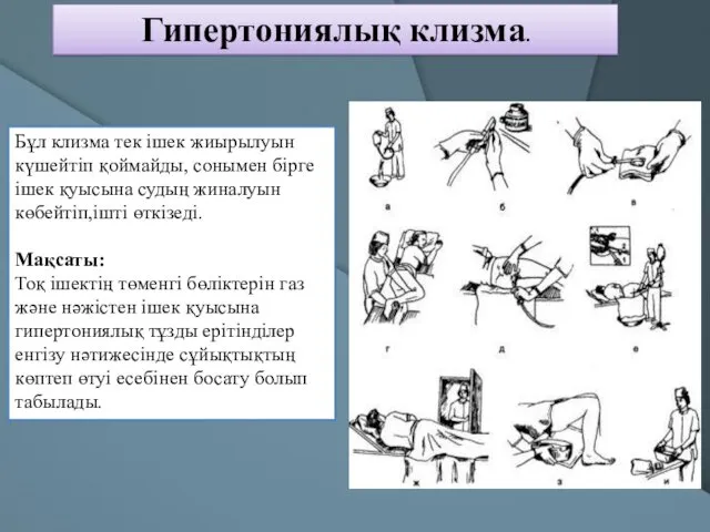 Гипертониялық клизма. Бұл клизма тек ішек жиырылуын күшейтіп қоймайды, сонымен