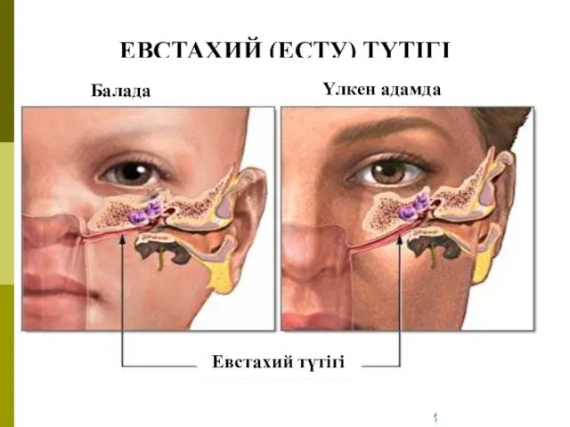 ЕВСТАХИЙ (ЕСТУ) ТҮТІГІ Евстахий түтігі Балада Үлкен адамда