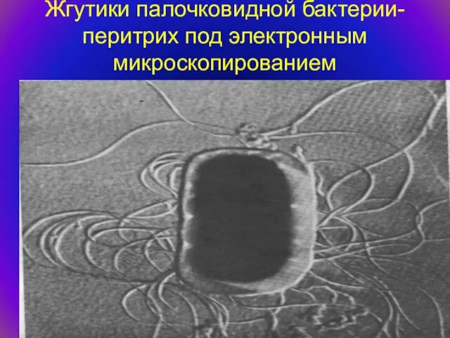 Жгутики палочковидной бактерии- перитрих под электронным микроскопированием