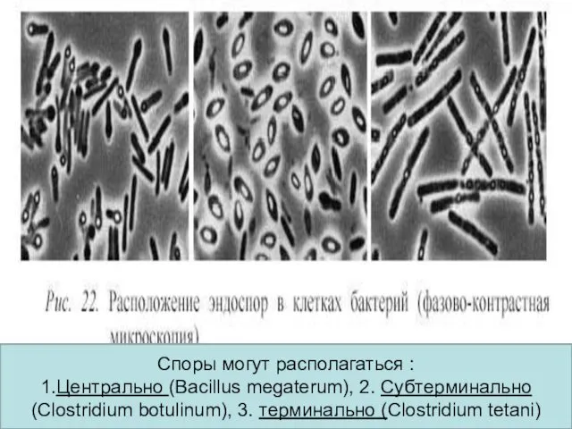 Р Споры могут располагаться : 1.Центрально (Bacillus megaterum), 2. Субтерминально (Clostridium botulinum), 3. терминально (Clostridium tetani)