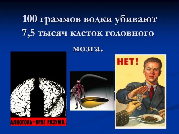 100 граммов водки убивают 7,5 тысяч клеток головного мозга.