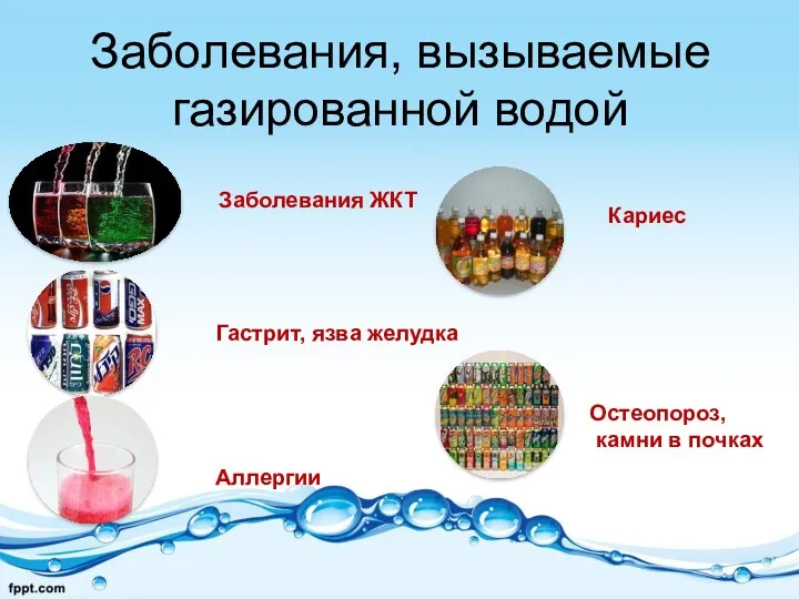 Заболевания, вызываемые газированной водой Заболевания ЖКТ Гастрит, язва желудка Аллергии Кариес Остеопороз, камни в почках