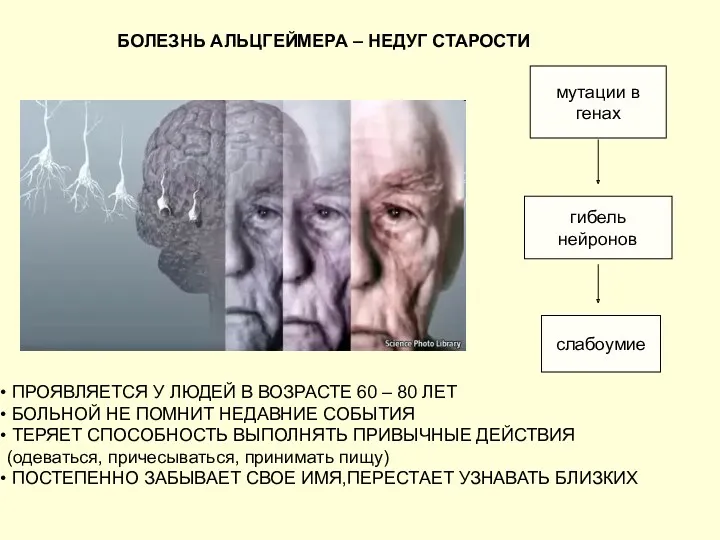 БОЛЕЗНЬ АЛЬЦГЕЙМЕРА – НЕДУГ СТАРОСТИ ПРОЯВЛЯЕТСЯ У ЛЮДЕЙ В ВОЗРАСТЕ