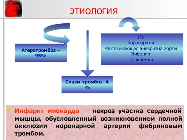 этиология Инфаркт миокарда - некроз участка сердечной мышцы, обусловленный возникновением