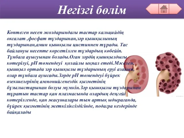 Негізгі бөлім Көптеген несеп жолдарындағы тастар кальцийдің оксалат ,фосфат тұздарынан,зәр