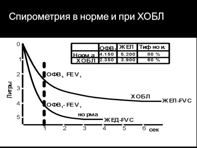 Спирометрия в норме и при ХОБЛ