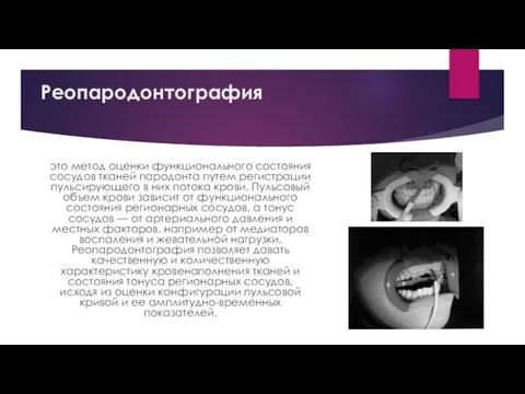 Реопародонтография это метод оценки функционального состояния сосудов тканей пародонта путем