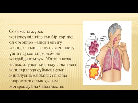 Созымалы жүрек жетіспеушілігіне тән бір көрінісі ол ортопноэ –айқын ентігу