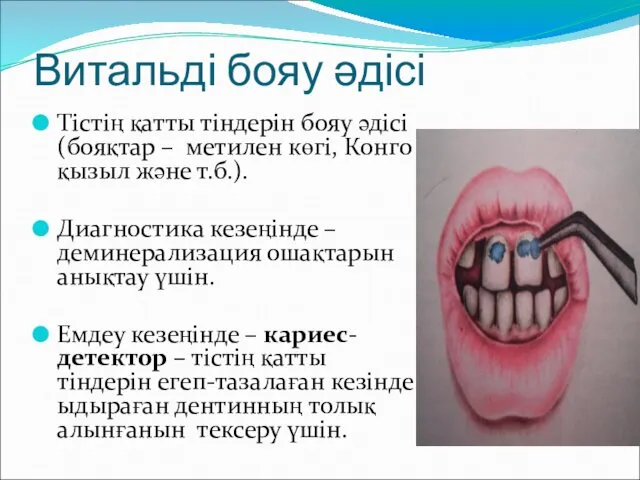 Витальді бояу әдісі Тістің қатты тіндерін бояу әдісі (бояқтар –