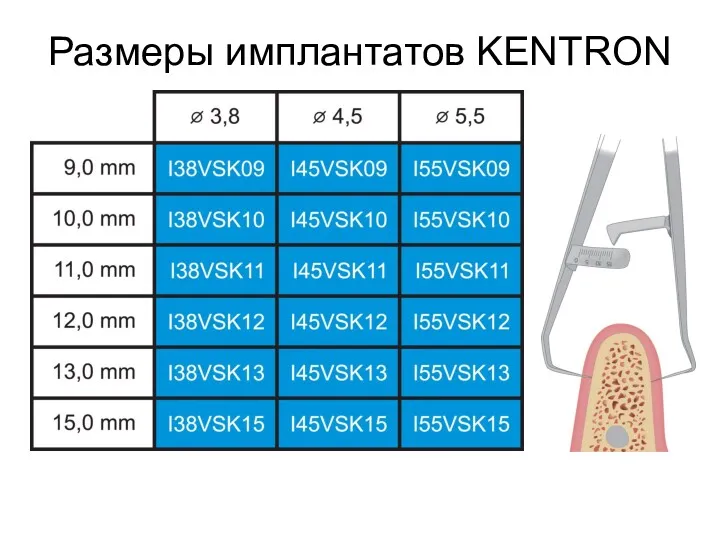 Размеры имплантатов KENTRON