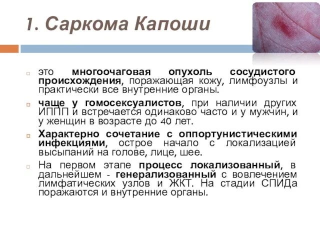 1. Саркома Капоши это многоочаговая опухоль сосудистого происхождения, поражающая кожу, лимфоузлы и практически