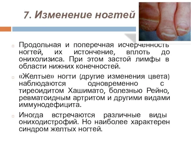 7. Изменение ногтей Продольная и поперечная исчерченность ногтей, их истончение, вплоть до онихолизиса.