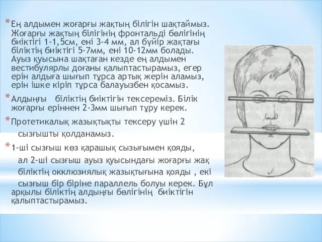 Ең алдымен жоғарғы жақтың білігін шақтаймыз. Жоғарғы жақтың білігінің фронтальді