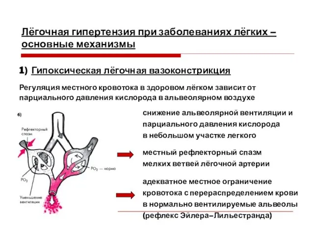 Лёгочная гипертензия при заболеваниях лёгких – основные механизмы 1) Гипоксическая