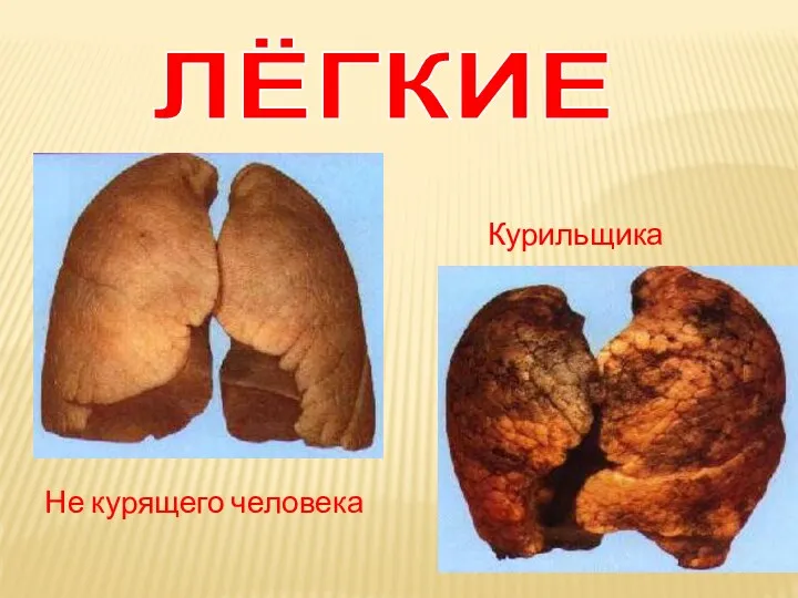 ЛЁГКИЕ Не курящего человека Курильщика