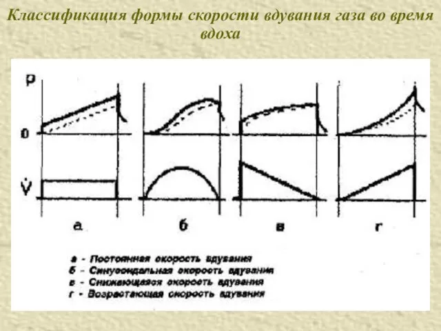 Классификация формы скорости вдувания газа во время вдоха