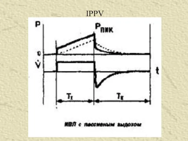 IPPV