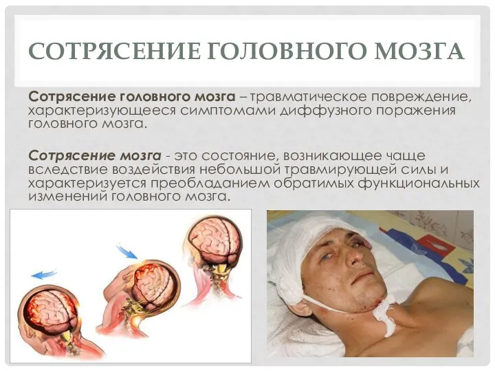 СОТРЯСЕНИЕ ГОЛОВНОГО МОЗГА Сотрясение головного мозга – травматическое повреждение, ха­рактеризующееся