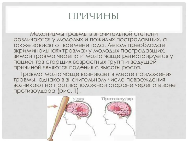 ПРИЧИНЫ Механизмы травмы в значительной степени различаются у молодых и