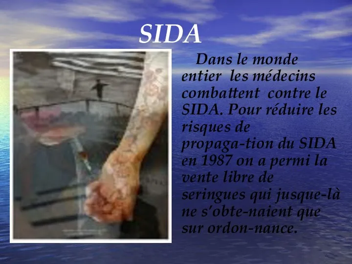 SIDA Dans le monde entier les médecins combattent contre le