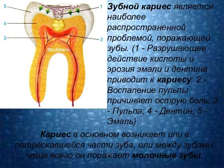 Кариес в основном возникает или в потрескавшейся части зуба, или