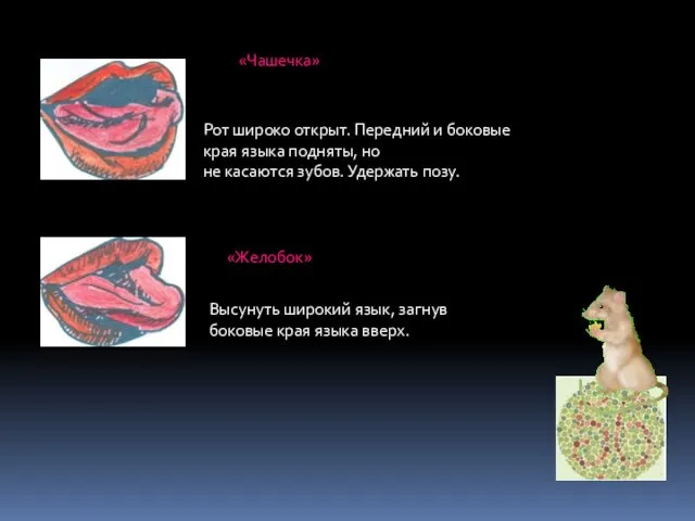 «Чашечка» Рот широко открыт. Передний и боковые края языка подняты,