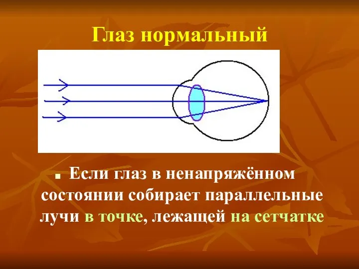 Глаз нормальный Если глаз в ненапряжённом состоянии собирает параллельные лучи в точке, лежащей на сетчатке