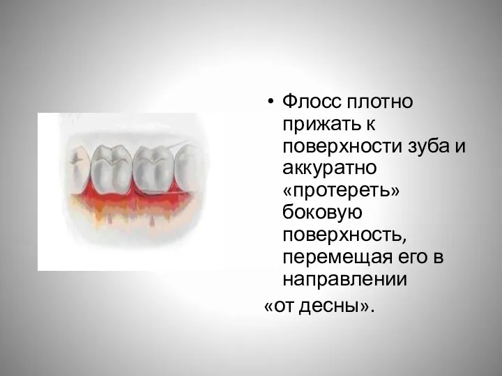 Флосс плотно прижать к поверхности зуба и аккуратно «протереть» боковую