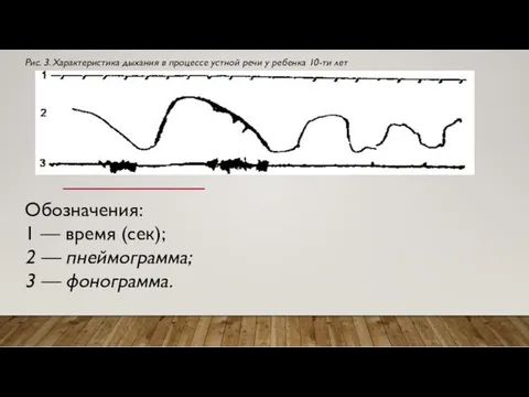 Обозначения: 1 — время (сек); 2 — пнеймограмма; 3 —