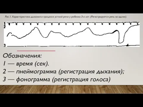 Обозначения: 1 — время (сек). 2 — пнеймограмма (регистрация дыхания);