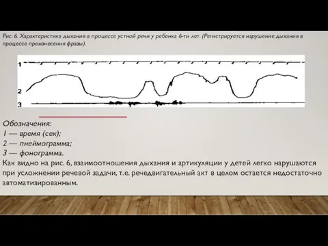 Обозначения: 1 — время (сек); 2 — пнеймограмма; 3 —