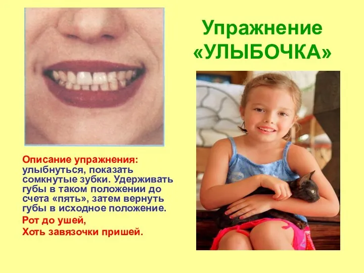 Упражнение «УЛЫБОЧКА» Описание упражнения: улыбнуться, показать сомкнутые зубки. Удерживать губы