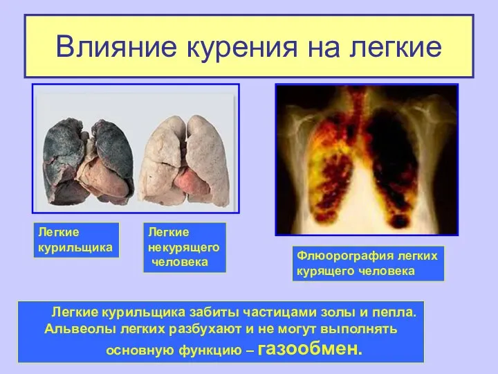 Влияние курения на легкие Легкие курильщика Легкие некурящего человека Флюорография
