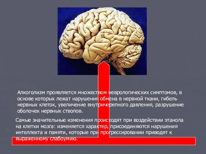 Алкоголизм проявляется множеством неврологических симптомов, в основе которых лежат нарушения