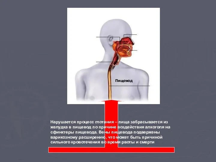 Пищевод Нарушается процесс глотания – пища забрасывается из желудка в