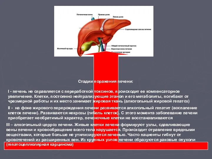 Стадии поражения печени: I - печень не справляется с переработкой