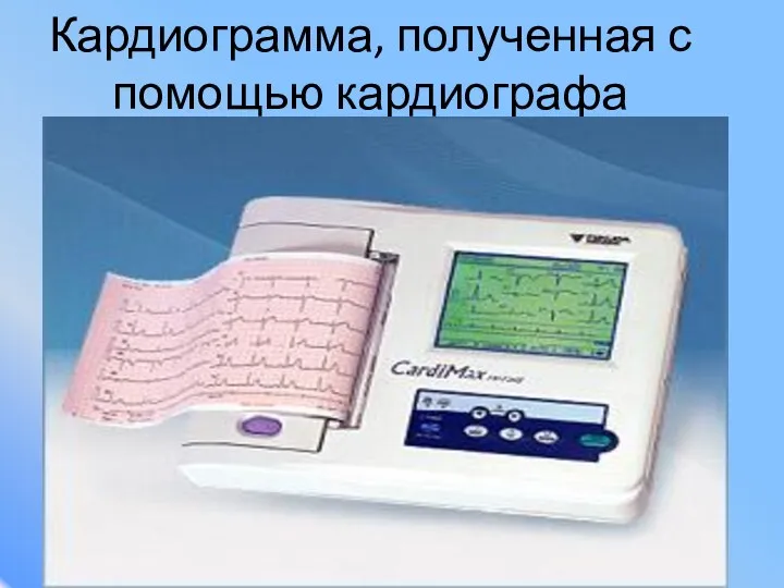 Кардиограмма, полученная с помощью кардиографа