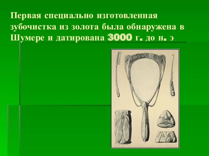 Первая специально изготовленная зубочистка из золота была обнаружена в Шумере