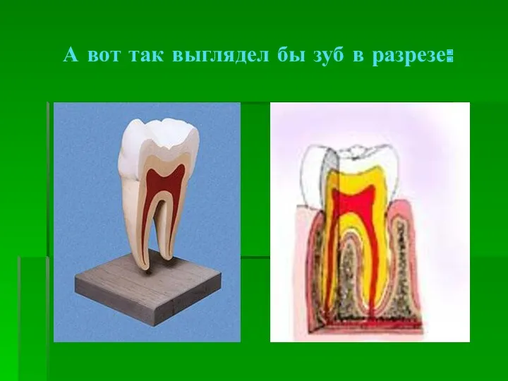 А вот так выглядел бы зуб в разрезе: