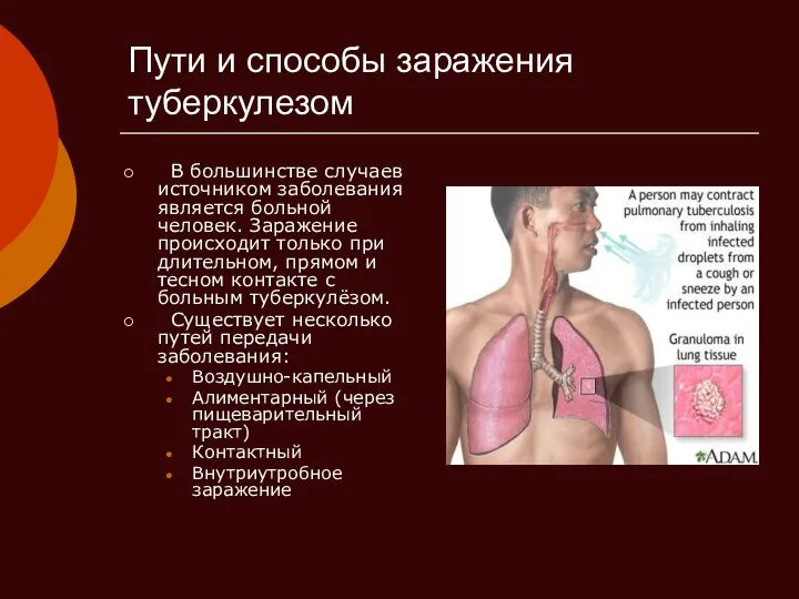 Пути и способы заражения туберкулезом В большинстве случаев источником заболевания