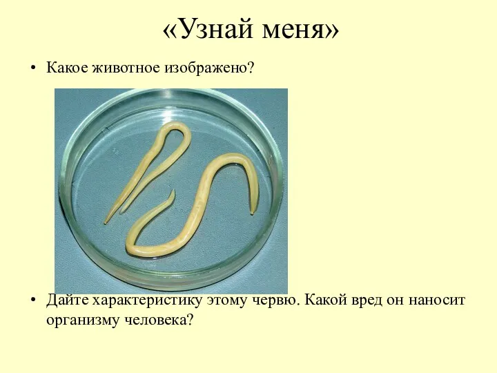 «Узнай меня» Какое животное изображено? Дайте характеристику этому червю. Какой вред он наносит организму человека?