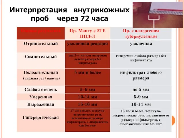 Интерпретация внутрикожных проб через 72 часа