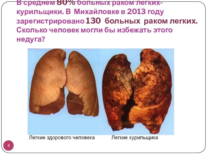 В среднем 80% больных раком легких- курильщики. В Михайловке в