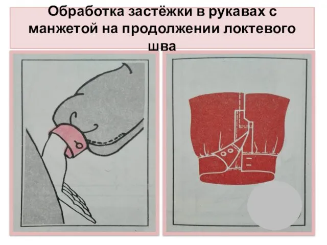 Обработка застёжки в рукавах с манжетой на продолжении локтевого шва