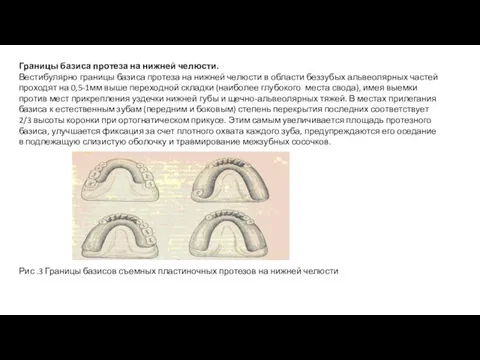 Границы базиса протеза на нижней челюсти. Вестибулярно границы базиса протеза на нижней челюсти