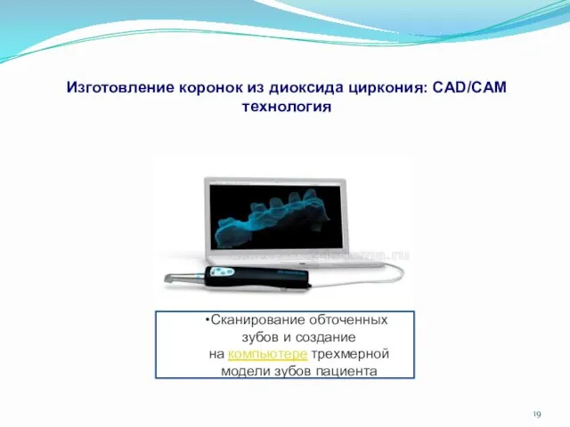 Изготовление коронок из диоксида циркония: CAD/CAM технология Сканирование обточенных зубов и создание на