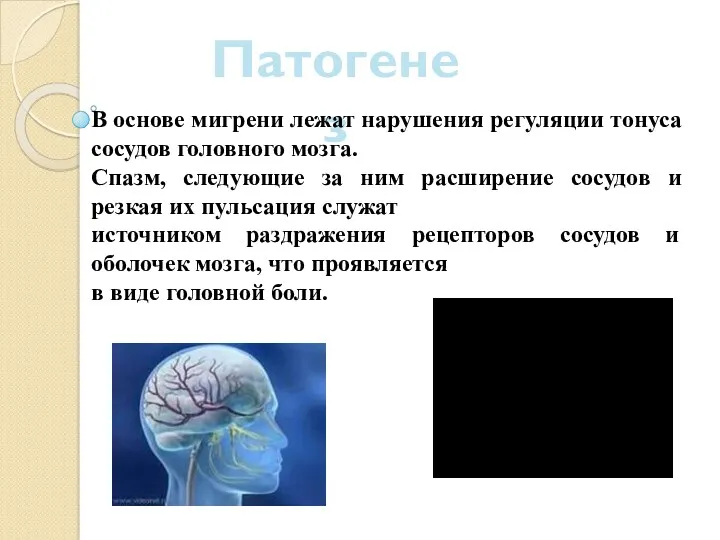 Патогенез В основе мигрени лежат нарушения регуляции тонуса сосудов головного