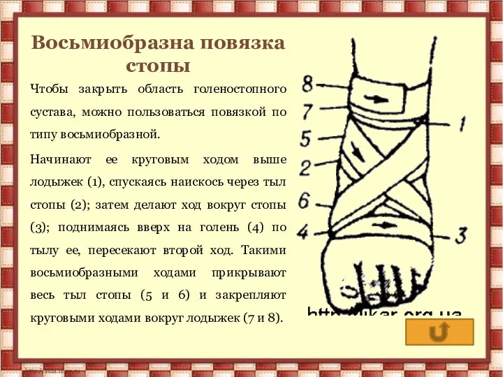 Восьмиобразна повязка стопы Чтобы закрыть область голеностопного сустава, можно пользоваться