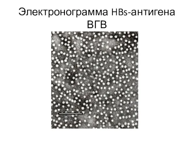Электронограмма HBs-антигена ВГВ